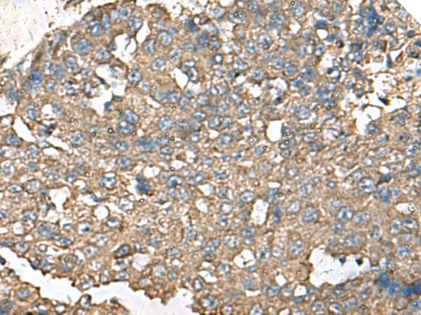 Polyclonal Rabbit anti-Human RPS14 / Ribosomal Protein S14 Antibody (IHC, WB)