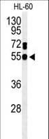 GDA / Nedasin Antibody (aa94-122)