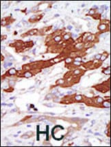 SGK3 Antibody (aa1-30)