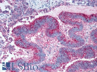 PathPlus™ GPR19 Antibody (Cytoplasmic Domain)