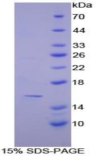 Human CASP7 / Caspase 7 Protein (Recombinant His-T7)
