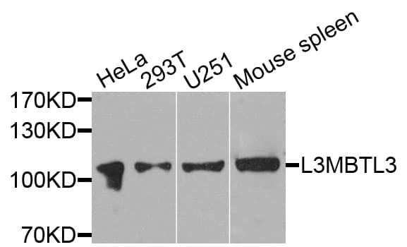 L3MBTL3 Antibody