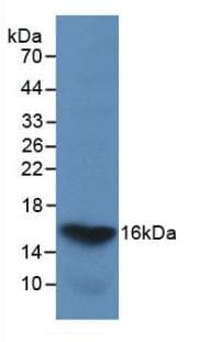 LGALS2 / Galectin 2 Antibody (aa1-132)