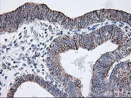 DLD / Diaphorase / E3 Antibody (clone OTI4E11)