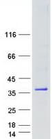 Human OLIG1 Protein (Recombinant Myc-DDK (Flag))