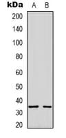 Polyclonal Rabbit anti-Human STX1A / Syntaxin 1A Antibody (Internal, WB)