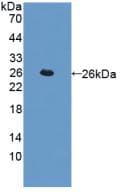 CTSL / Cathepsin L Antibody (aa114-288, APC)