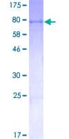Human ALDH2 Protein (Recombinant GST)