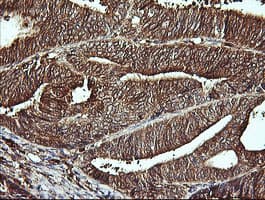 LGALS3 / Galectin 3 Antibody (clone OTI1A3)