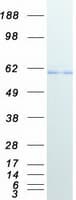 Human HDAC1 Protein (Recombinant Myc-DDK (Flag))