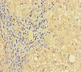 PRICKLE4 Antibody