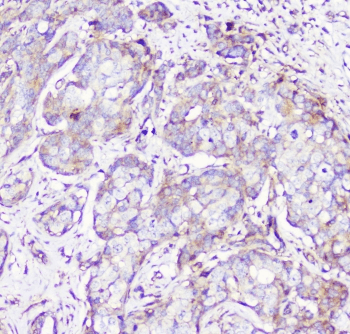 RP2 Antibody