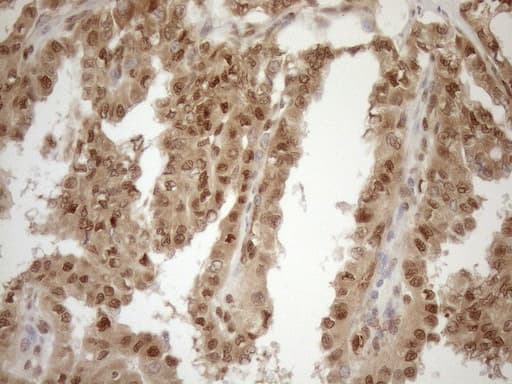 MGMT Antibody (clone OTI10H9)