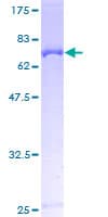 Human PLIN3 / M6PRBP1 / TIP47 Protein (Recombinant GST)