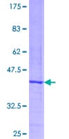Human TAC1 Protein (Recombinant GST)