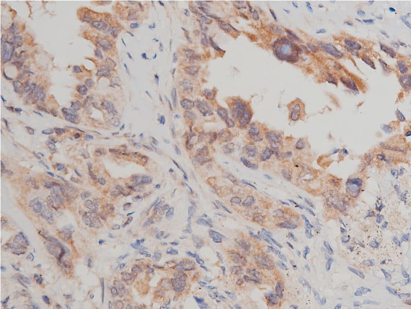 MTOR Antibody (phospho-Ser2448)