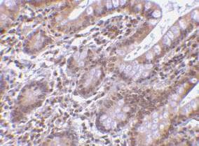 Polyclonal Rabbit anti-Human BIRC7 / Livin Antibody (aa264-280, IHC, WB)