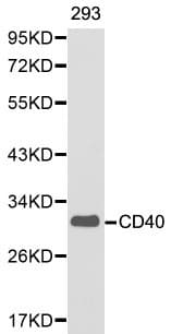 Polyclonal Rabbit anti-Human CD40 Antibody (WB)