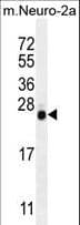 LIN28A / LIN28 Antibody