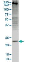 CRYGD / CCP Antibody (clone 4E12)