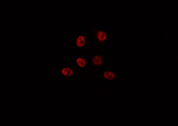 Polyclonal Rabbit anti-Human SCAF1 Antibody (IF, WB)
