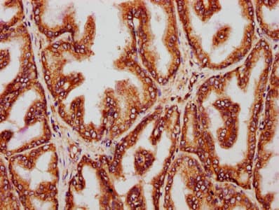YWHAQ / 14-3-3 Theta Antibody (aa1-245)