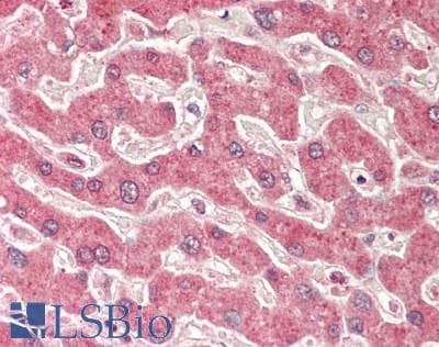 Polyclonal Rabbit anti-Human KRT19 / CK19 / Cytokeratin 19 Antibody (aa251-300, IHC, WB)