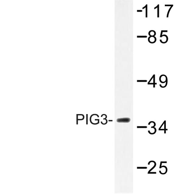 TP53I3 / PIG3 Antibody (Leu265)