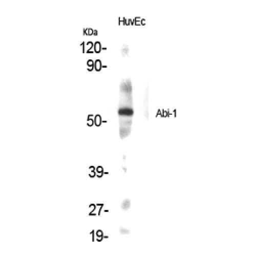 ABI1 / SSH3BP1 Antibody (Internal)