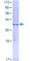 Human MELK Protein (Recombinant GST, N-terminus)