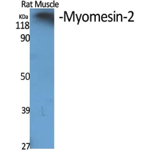 MYOM2 / Myomesin 2 Antibody (590-670 aa, Internal)