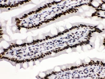 TRIM28 / KAP1 Antibody