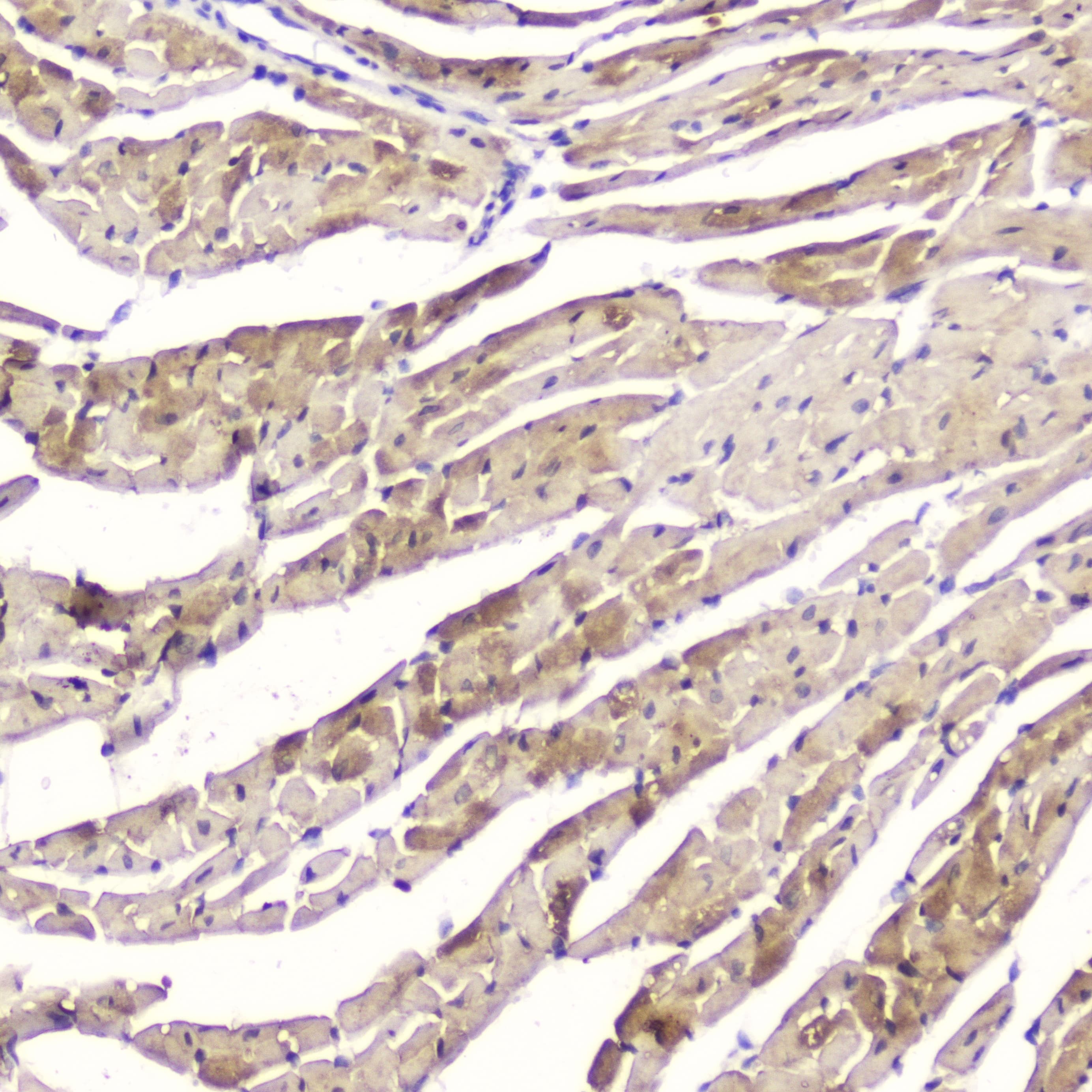 FABP3 / H-FABP Antibody