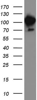 MCAM / CD146 Antibody (clone UMAB155)