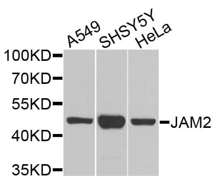 JAM2 Antibody
