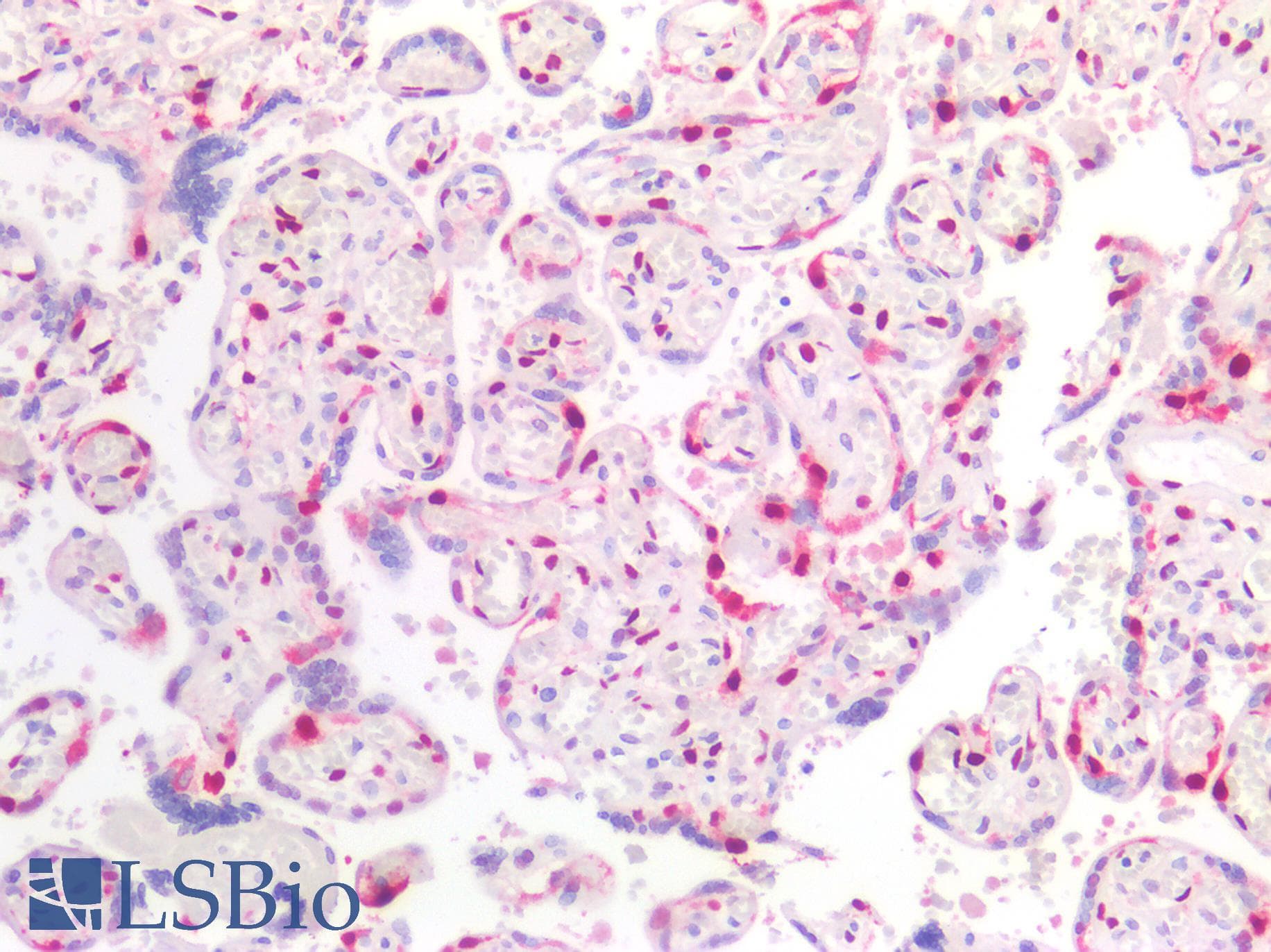 PathPlus™ CDKN1C / p57 Kip2 Antibody (Concentrated)