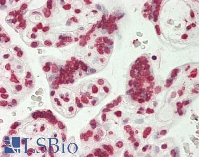 IHC-plus™ PAR / Poly ADP-Ribose Antibody (clone 10H)