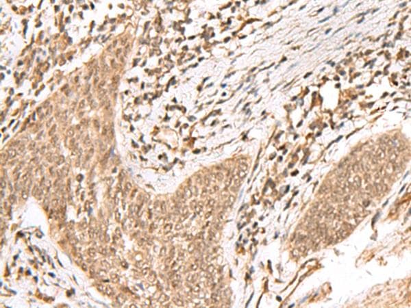 JHDM1A / KDM2A Antibody