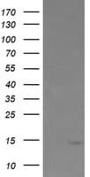 TPD52L3 Antibody (clone OTI7E10)
