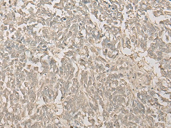 FYTTD1 Antibody
