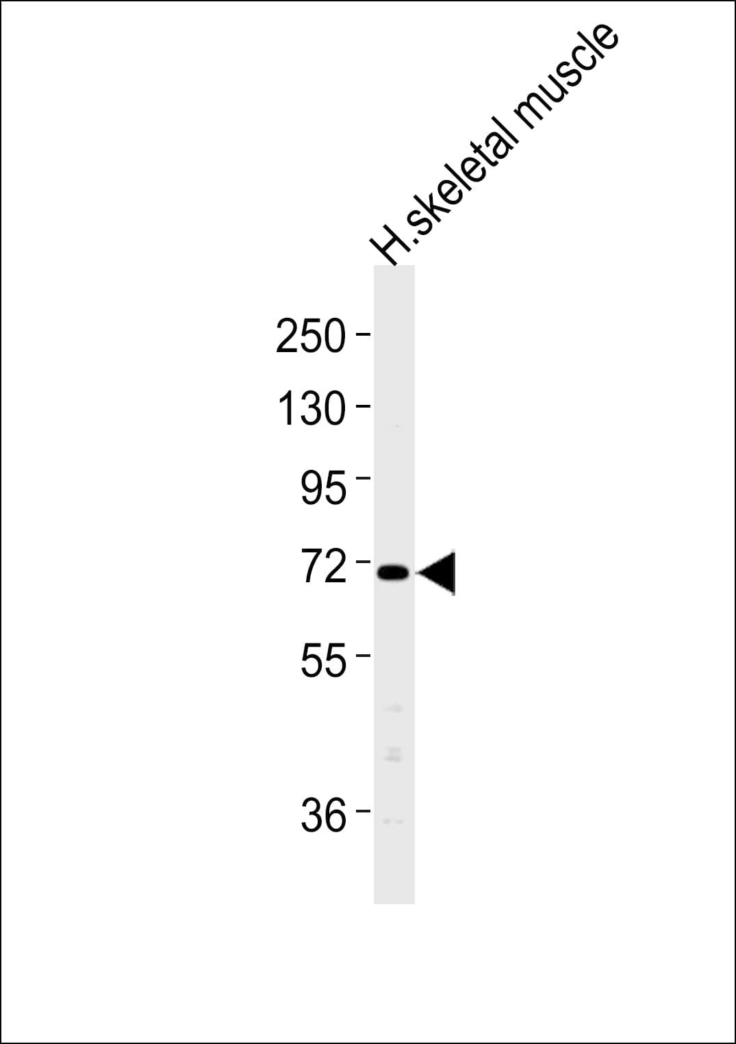 Polyclonal Rabbit anti-Human CLCN4 / CLC-4 Antibody (WB)
