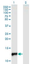 Monoclonal Mouse anti-Human CYP24 / CYP24A1 Antibody (clone 1E1, WB)