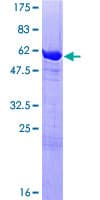 Human NACA Protein (Recombinant GST)