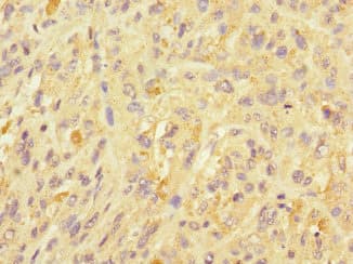 Polyclonal Rabbit anti-Human UBE2S / E2 EPF Antibody (IHC)
