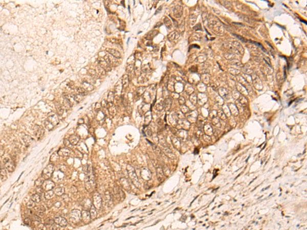 HIPK3 / FIST Antibody