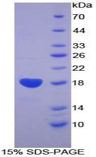Human BMPR2 Protein (Recombinant His-T7)
