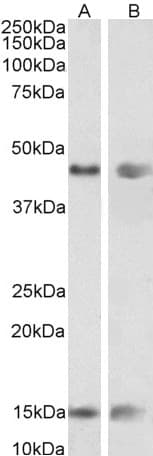 IHC-plus™ PNPLA3 / Adiponutrin Antibody (aa186-197)