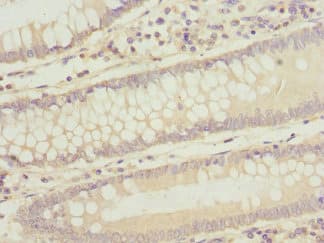 Polyclonal Rabbit anti-Human UBXD9 / ASPL Antibody (IHC, WB)