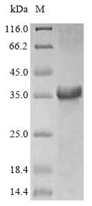 Rubber tree Major latex allergen Hev b 5(Hevea brasiliensis) Protein (Recombinant 6His, N-terminus)