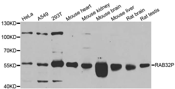 IHC-plus™ RAB3IP / RABIN3 Antibody